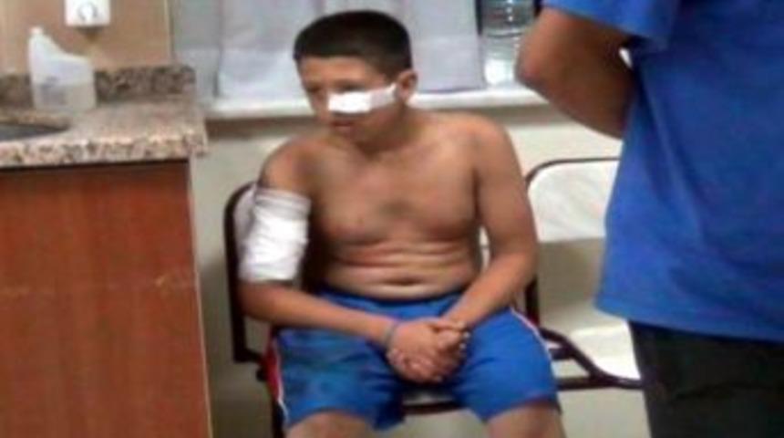 Eve Sıkılan Kurşunlar Balkondaki &Ccedil;ocuğu Yaraladı