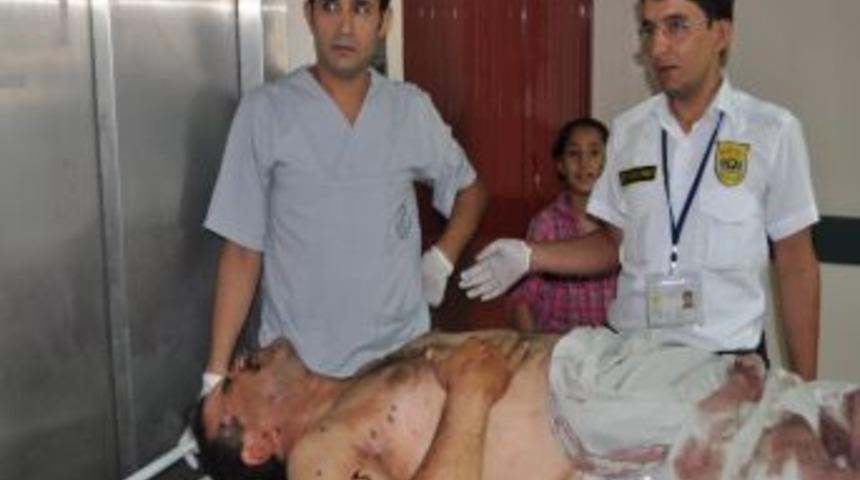 Yaralı 4 Suriyeli Nizip'e Getirildi