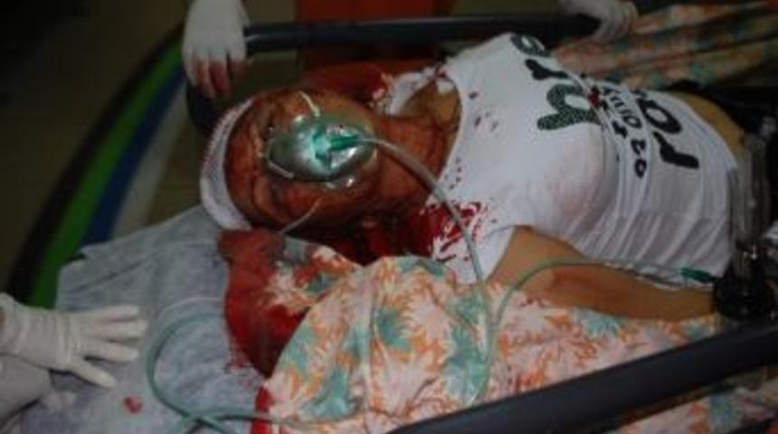 Darp Edilen Kadın Hastaneye Kaldırıldı