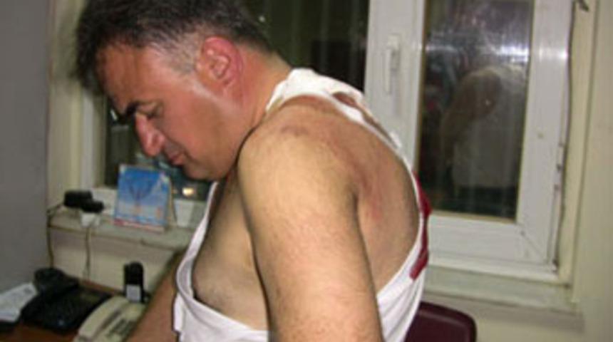 Cezaevi firarisi vurularak yakalandı