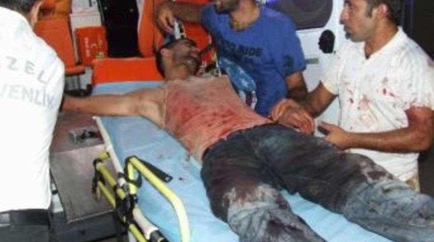 Kendi Parmağına Kesince Hastanelik Oldu