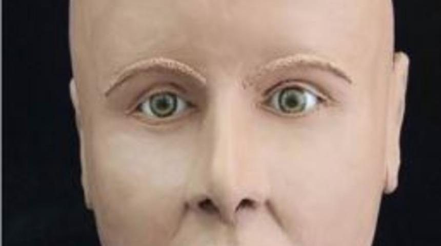 Me&ccedil;hul Kafatası Yeniden Y&uuml;zlendirildi