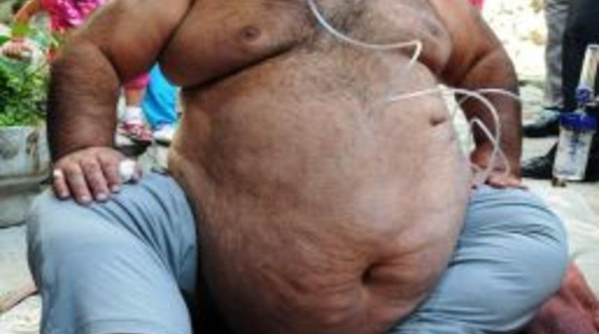 240 Kiloluk Adam, Hastaneye Itfaiye Ekiplerinin Yardımıyla G&ouml;t&uuml;r&uuml;ld&uuml;