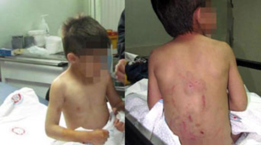 6 yaşındaki &ccedil;ocuğa anne işkencesi