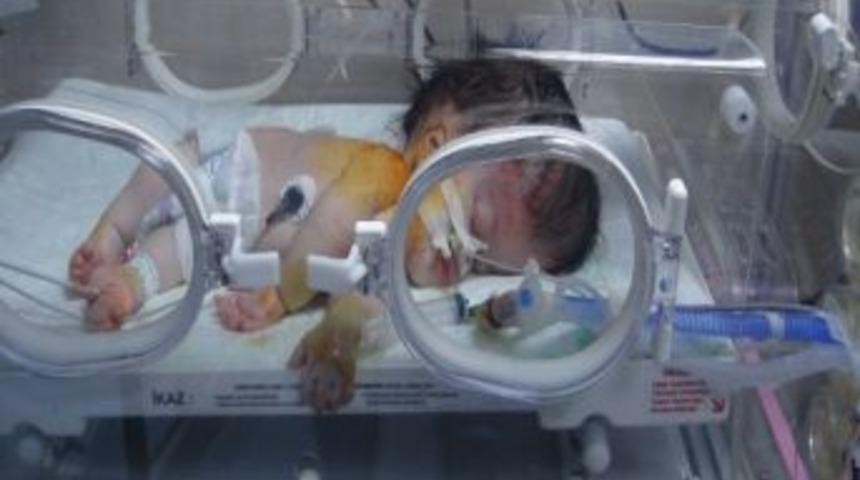 Kafası İki Katı B&uuml;y&uuml;kl&uuml;ğ&uuml;ndeki Bebeğin Tedavisi S&uuml;r&uuml;yor