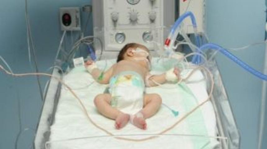 Cb&uuml; Hafsa Sultan Hastanesi'nde Başarılı Operasyon