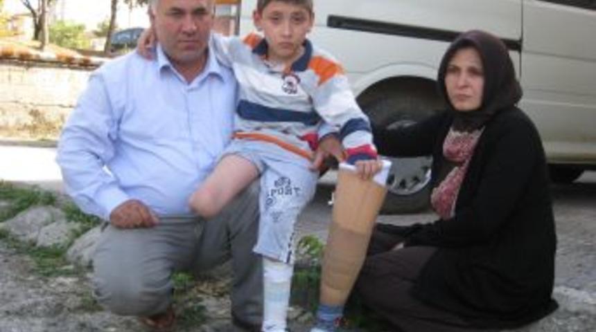 Doktorlar 'hastaneden Koşarak &Ccedil;ıkacak' Dedi, Ayağı Kesildi