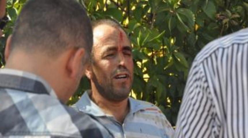 Antalya&rsquo;da 2b Kavgası: 1 Yaralı