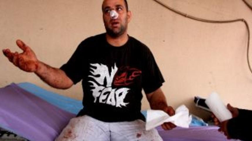 Acemi Kasaplar Hastaneye Koştu