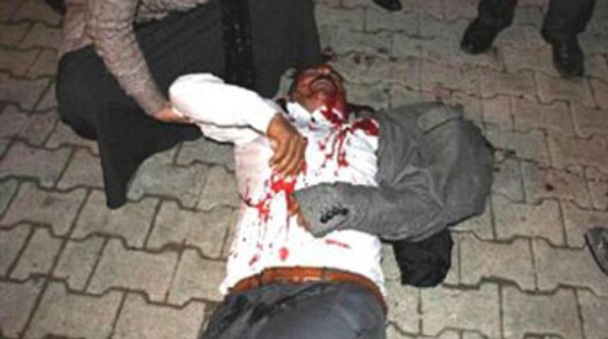 Başına gaz bombası isabet etti