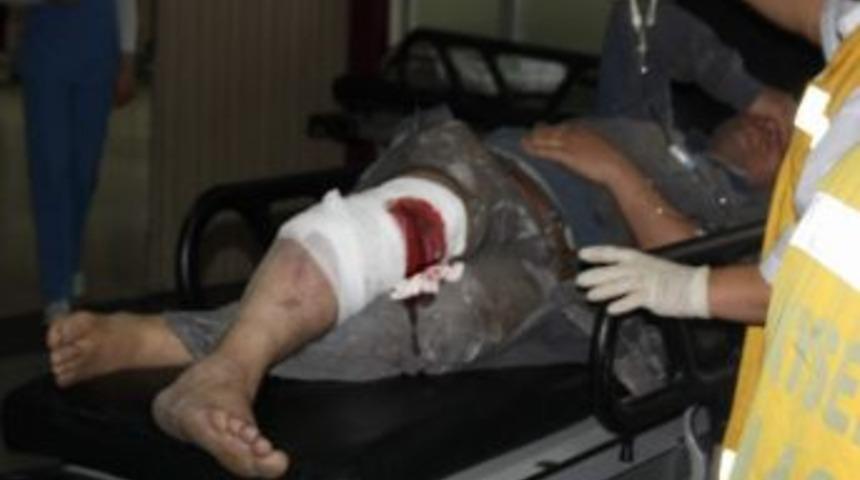 Kayseri&rsquo;de İş Kazası