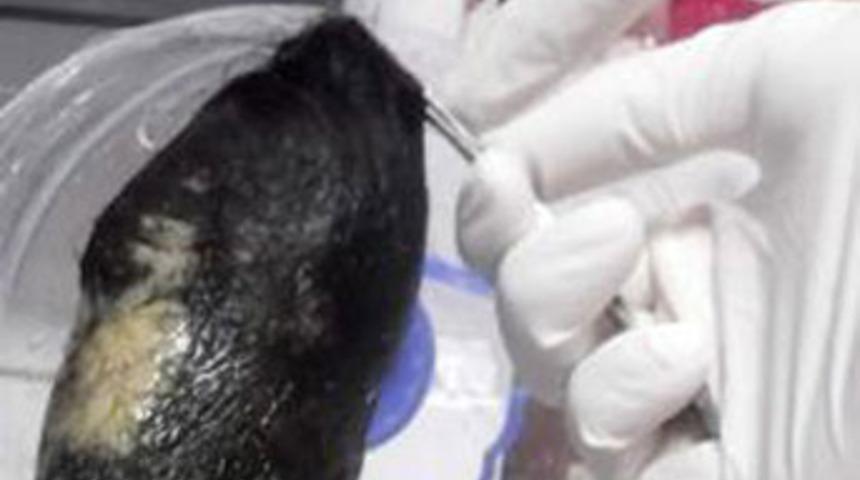 Midesinden yarım kilo sa&ccedil; &ccedil;ıktı