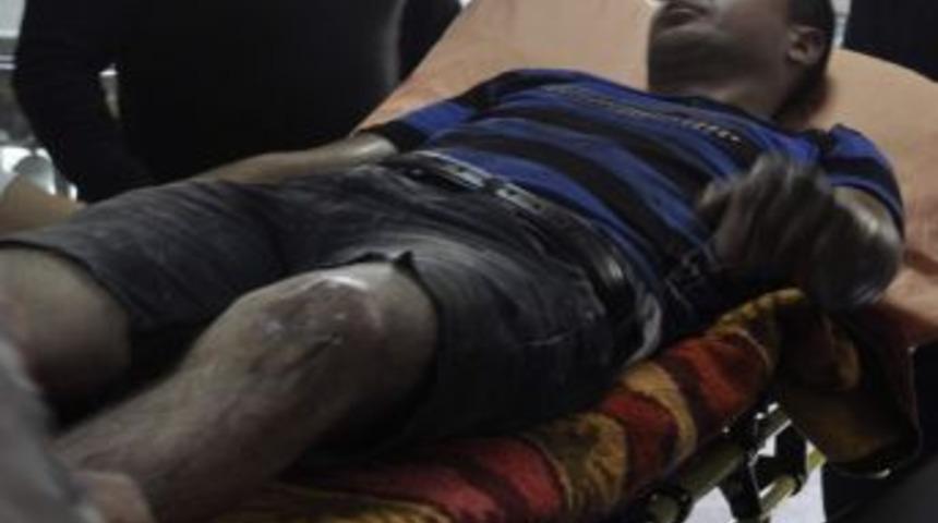 Kayseri&rsquo;de İş Kazası