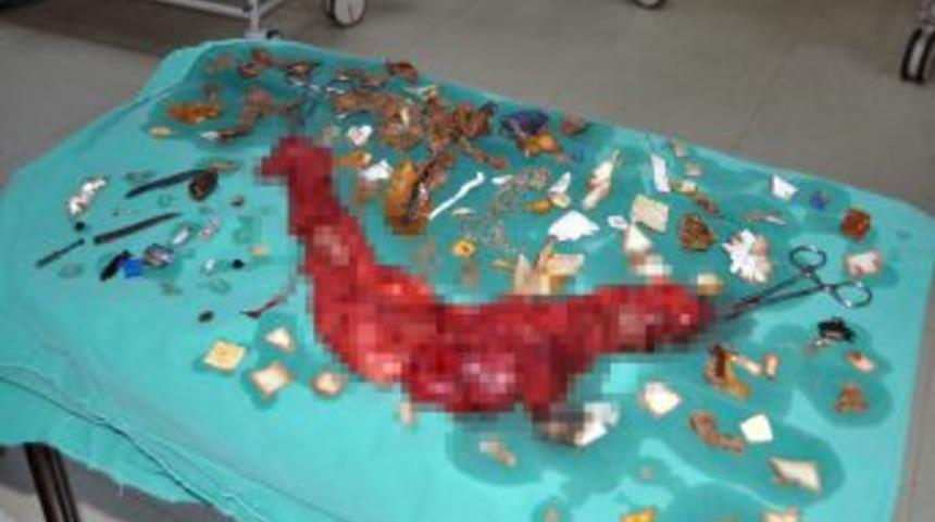 İskenderun&rsquo;da Şizofren Hastasının Bağırsaklarından Bı&ccedil;ak &Ccedil;ıktı