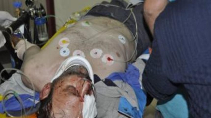 Kafasına Demir D&uuml;şen İş&ccedil;i Ağır Yaralandı