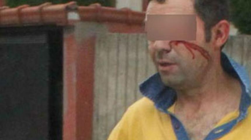 Fal&ccedil;atalı fantezi kanlı bitti