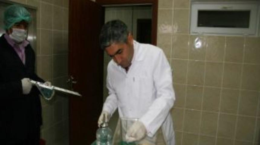 Kalın Bağırsak Kanserine Manda Yoğurdu