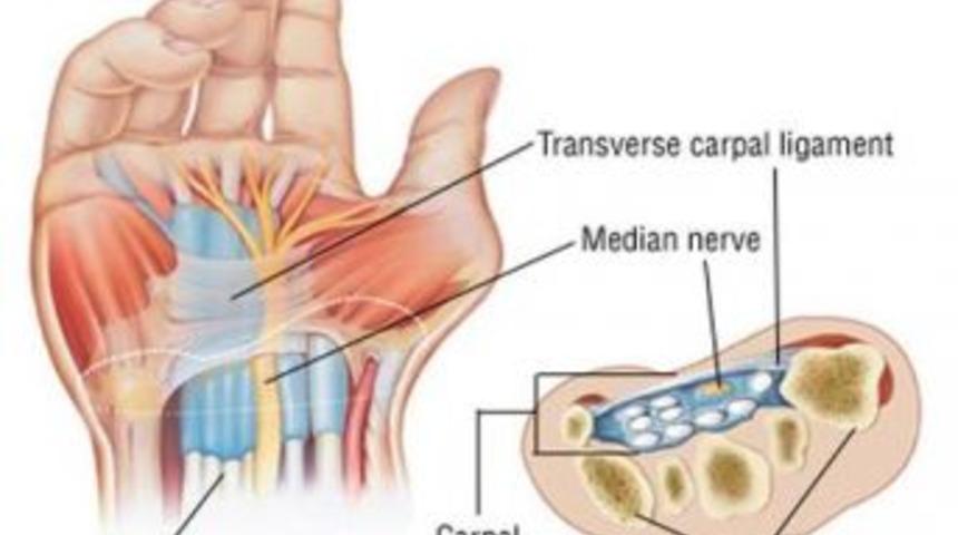 Ellerdeki Uyuşmaları Hafife Almayın