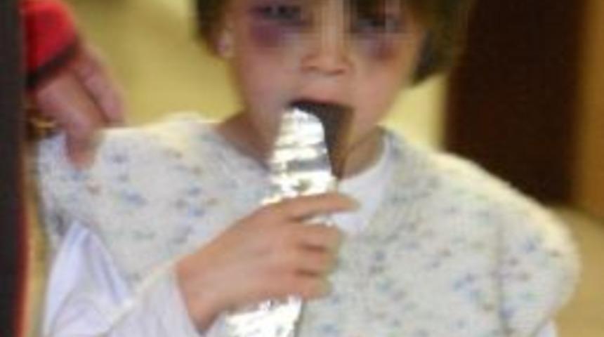 Annesinin D&ouml;vd&uuml;ğ&uuml; &Ccedil;ocuğa Devlet Bakacak