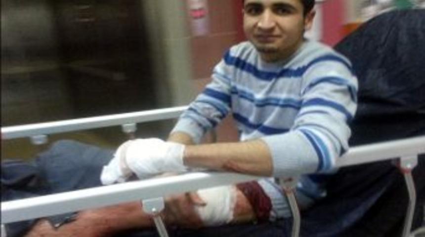 Aydın&rsquo;da &lsquo;niye Baktın&rsquo; Tartışması: 1 Yaralı