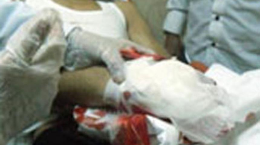 Polise atacağı bomba elinde patladı