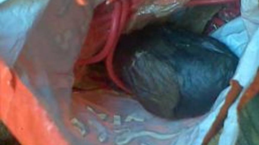 Hakkari'de 8 Terörist Etkisiz Hale Getirildi