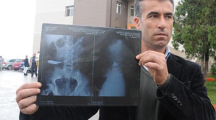 9 yıldır karnında bı&ccedil;akla yaşıyor