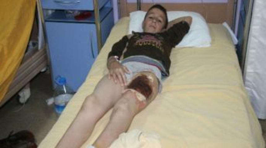 Suriye'den Getirilen 20 Yaralıdan 4&rsquo;&uuml; &Ouml;ld&uuml;