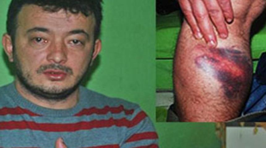 Polisler komaya soktu