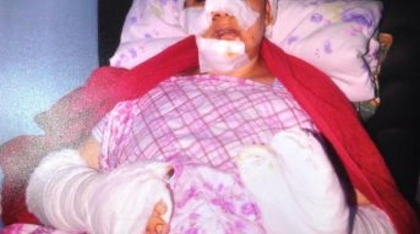 Eşine Bı&ccedil;akla Şiddet Uygulayan Koca Hakim Karşısında