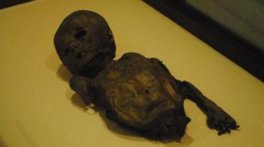 1.5 Yaşında Mumyalanmış