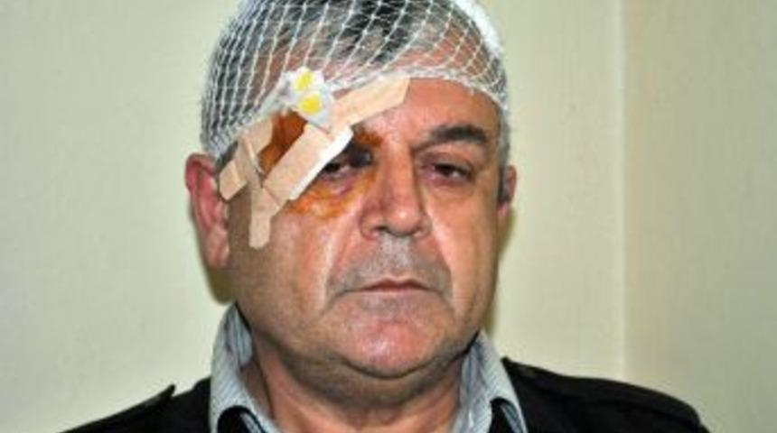 (&ouml;zel Haber) Emekli Polisten Başkana Dayak Su&ccedil;laması