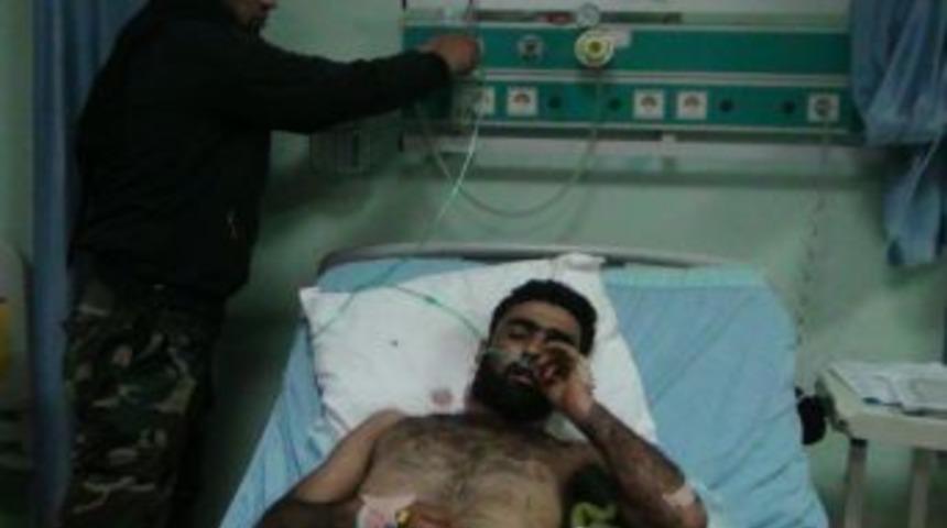 Suriye'den Kilis'e Getirilen 27 Yaralıdan 2'si Hayatını Kaybetti