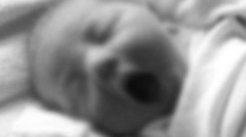 Yemek borusuna dolan mama &ouml;ld&uuml;rd&uuml;