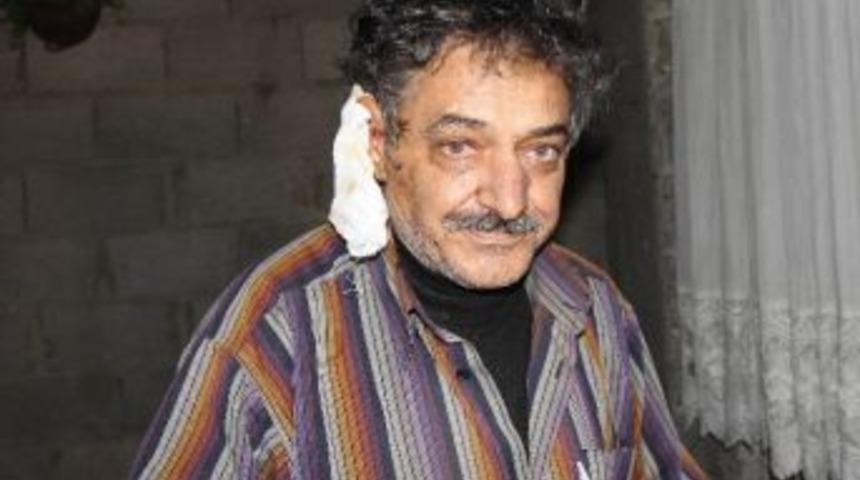 (&ouml;zel Haber) Eve Bakmayan Kocasının Kulağını Kesti