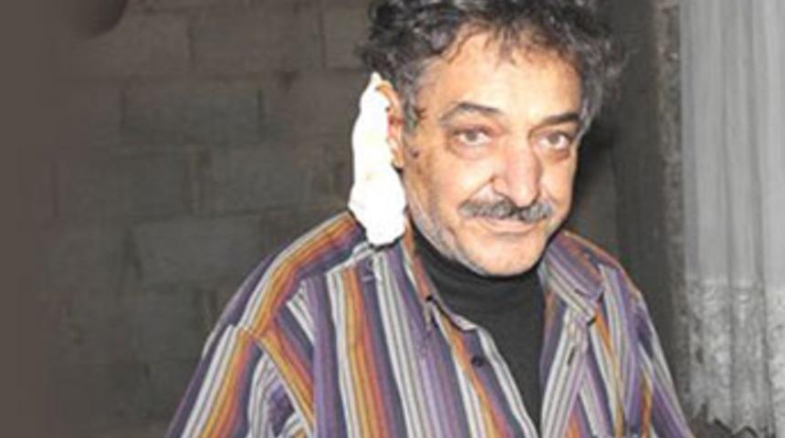 Kocasının kulağını kesti