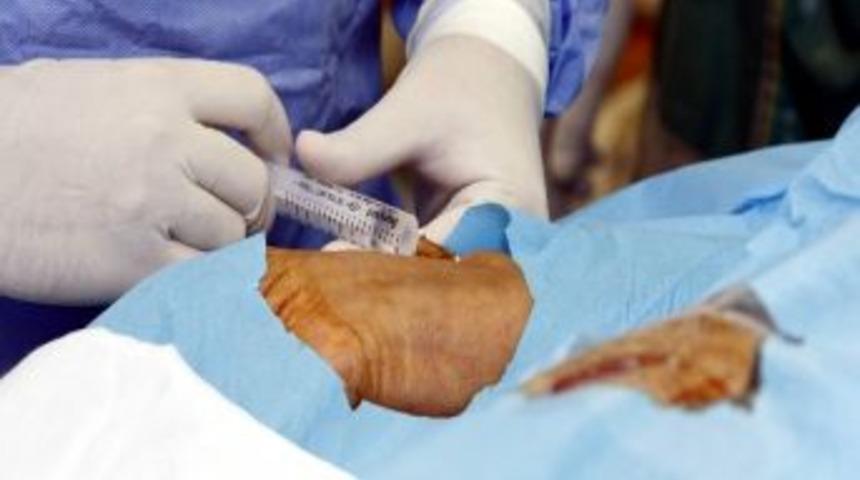 Bacak Damarına Stent Uygulandı, Ameliyata Gerek Kalmadı