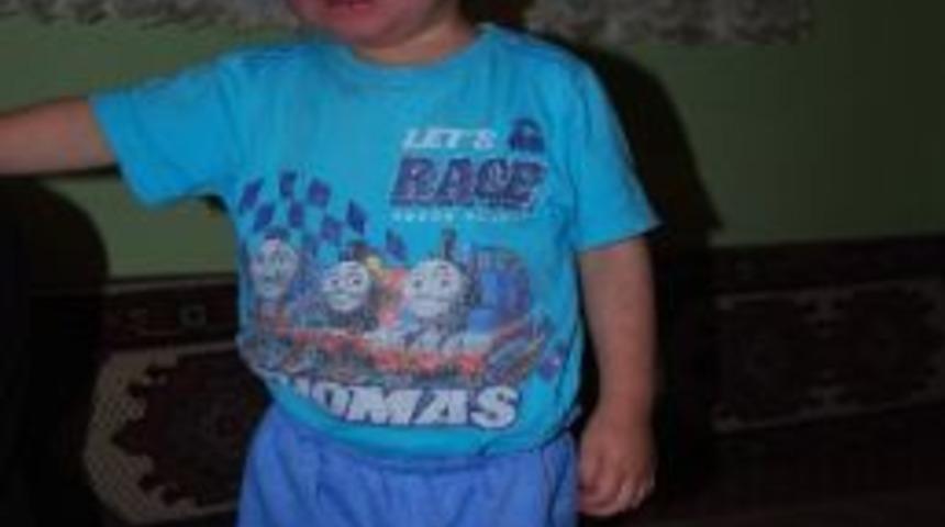 Bir Sivilce Abd&uuml;ssamed&rsquo;in Hayatını Kararttı