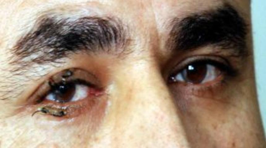 Elbistan'da G&ouml;rmeyen G&ouml;z Hamile Bir Bayandan Alınan Kordon Zarıyla A&ccedil;ıldı