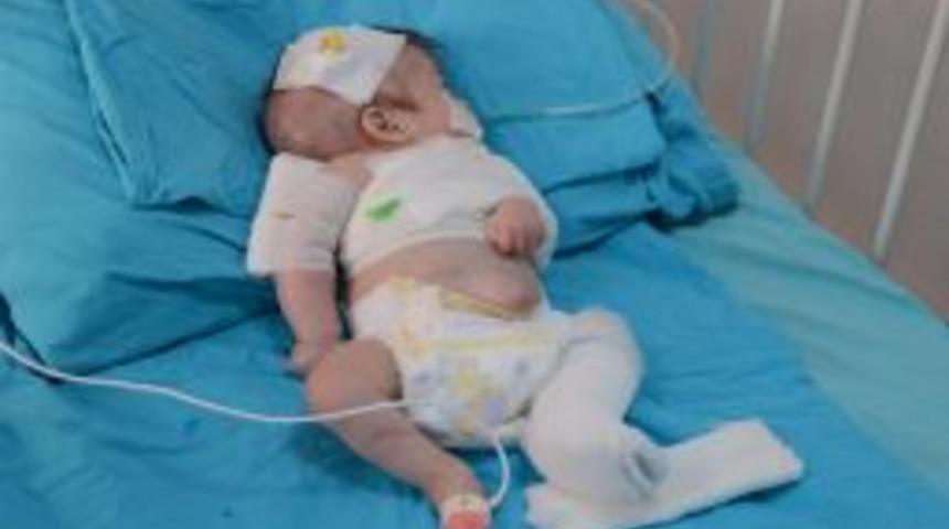 Annesi Tarafından Darp Edilen Bebeğin Tedavisi S&uuml;r&uuml;yor