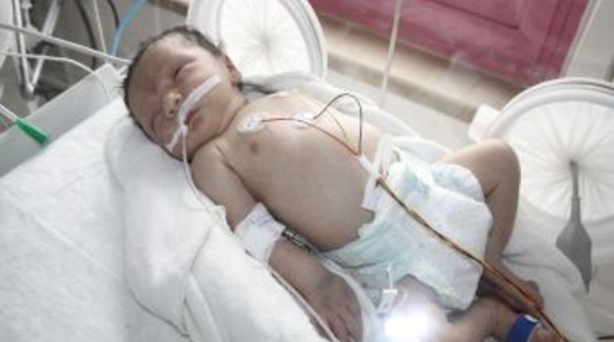 Doğumundan 10 Dakika Sonra Ameliyatla Kalp Kapakçığı Onarıldı