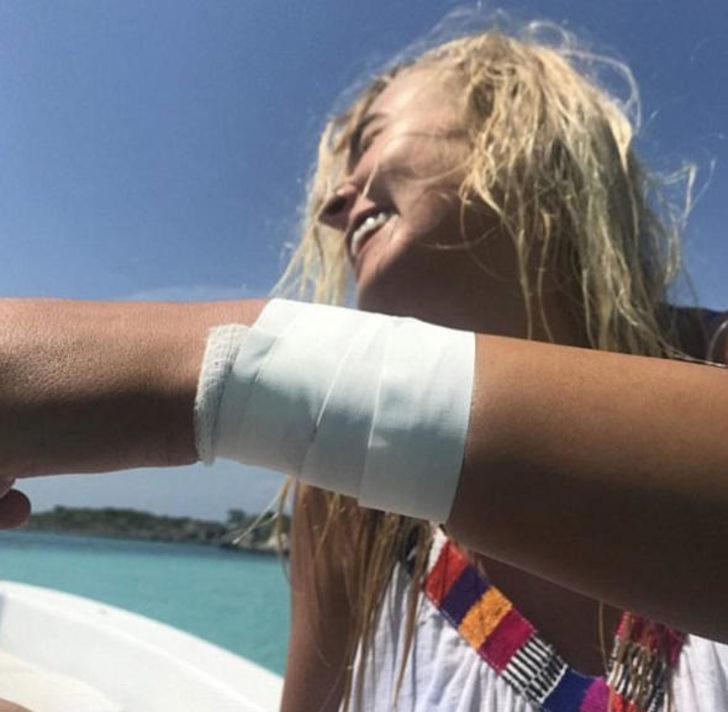 Denizde korkunç anlar! Köpek balığı saldırdı kanlar içinde yere yığıldı G4