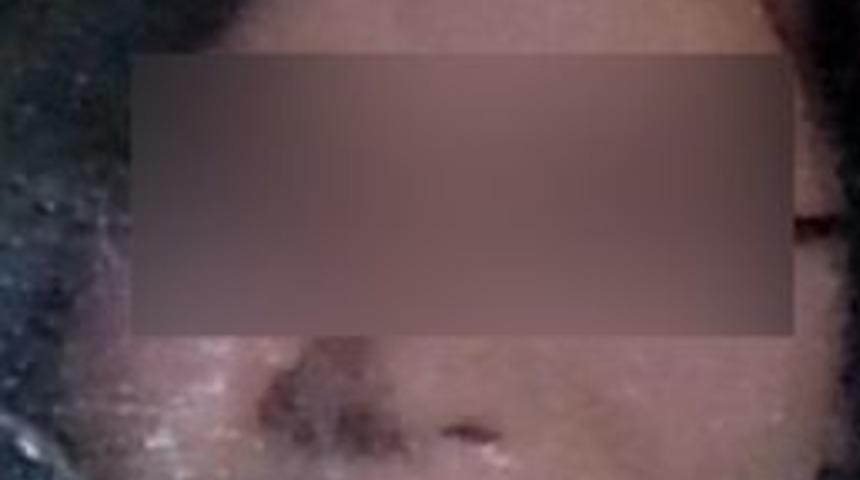 Hırsızlıkla Su&ccedil;lanan Gen&ccedil; Kız, &Ouml;ğrenci Yurdunun 5. Katından Atladı