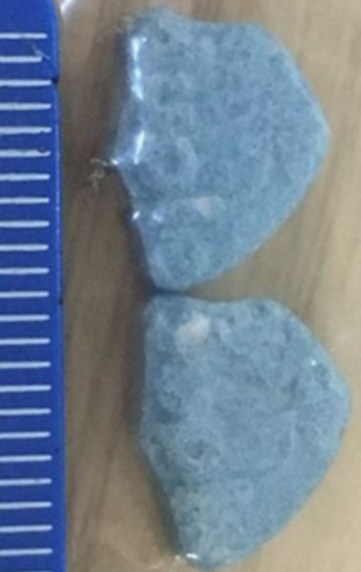 15 yaşındaki kız bir anda komaya girdi! Ailesi nedenini öğrenince şok geçirdi G4