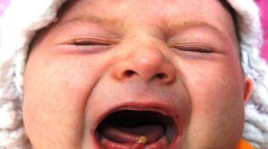 Umut Bebek Dişiyle D&uuml;nyaya Geldi