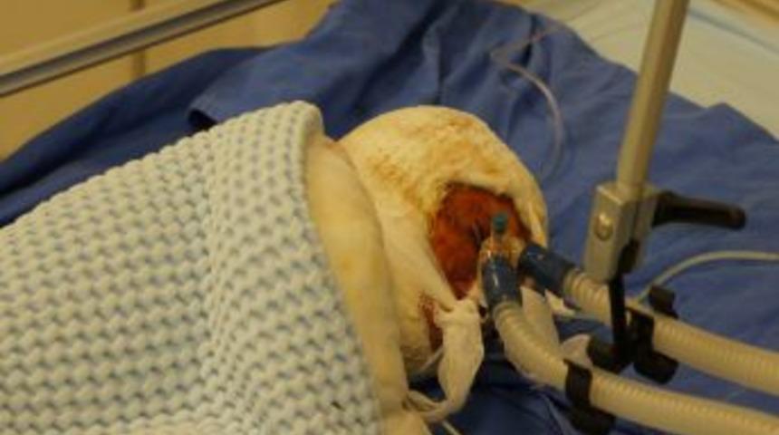 Esed'in Bombaladığı Suriyeliler, Adana'da Şifa Arıyor