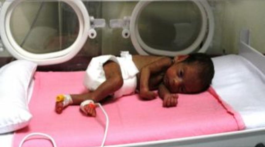 810 Gram Doğdu, Hayata Tutundu