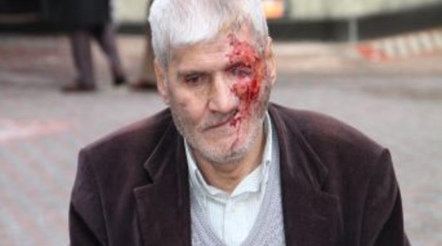 Y&uuml;z Nakli Isteyen Şadi Durmuş&rsquo; A Devlet Eli Uzanıyor