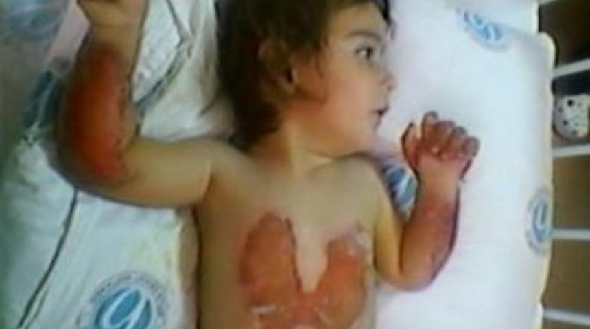 &Uuml;zerine Kaynar Su D&ouml;k&uuml;len Minik Fatmag&uuml;l&rsquo;e Kaymakamlık Sahip &Ccedil;ıktı