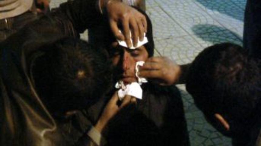 Adıyaman&rsquo;da Otomobil İle Motosiklet &Ccedil;arpıştı: 1 Yaralı